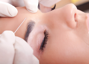 Aplicación de botox en 1 zona en Clínica Sanza Barcelona